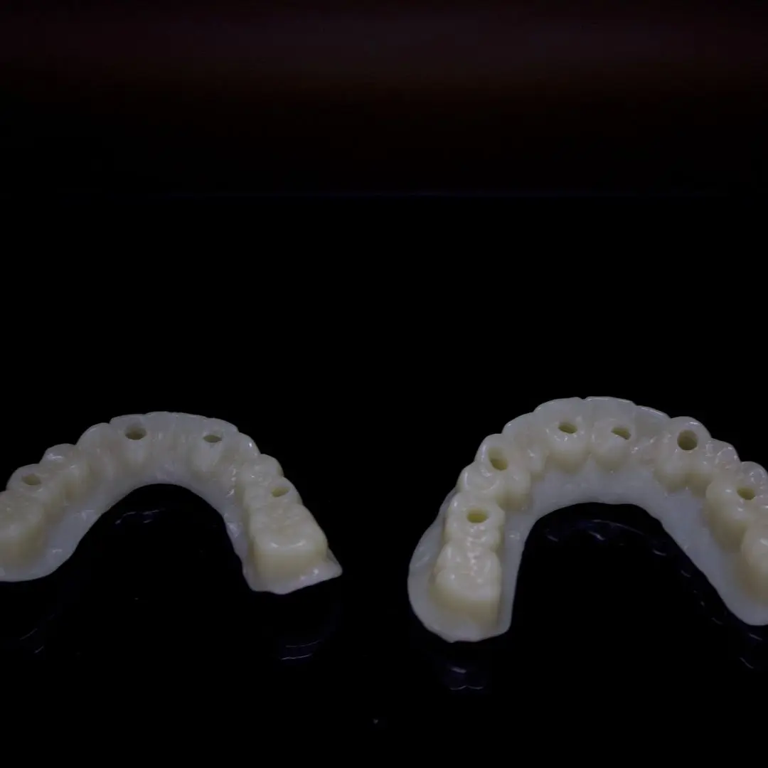 Full-arch PMMA esthetic try-in over implants