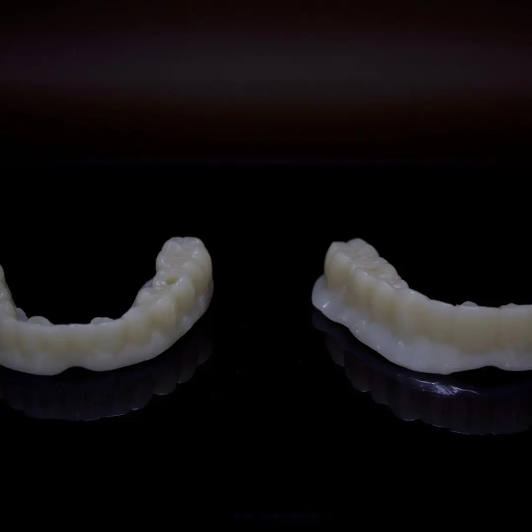 Multilayer PMMA prototype for an All-on-6 rehabilitation
