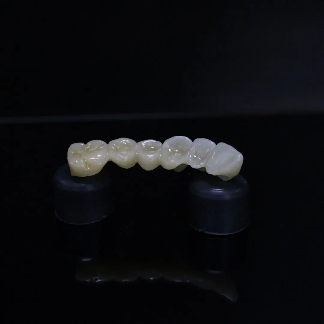 6-unit multilayer zirconia bridge manufactured at 3DigitaLab